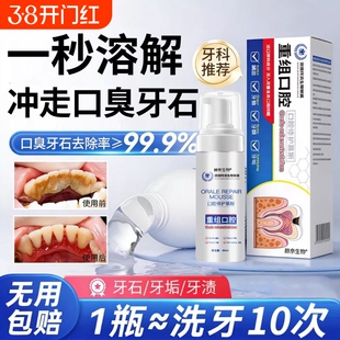 牙结石溶解剂便携漱口水杀菌除去口臭炎持久留香口腔牙周清理医用