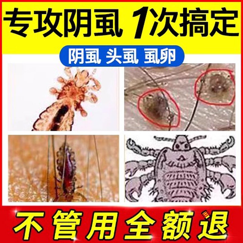 灭阴虱药喷剂女男士用私处虫卵双杀一扫光成人百部酊虱子专用正品