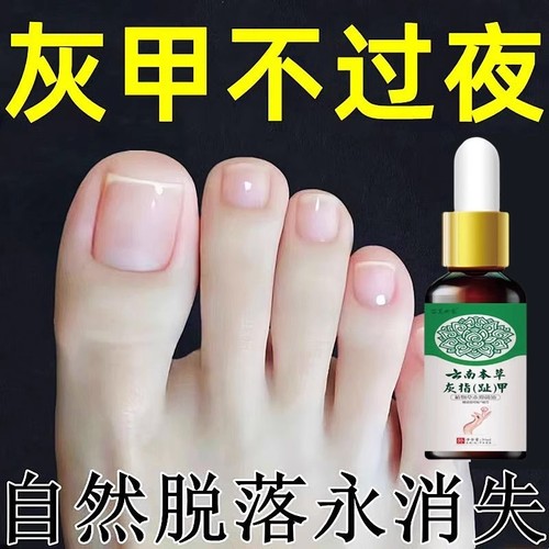 灰指甲专用药正品旗舰店亮甲正品灰指甲抑菌液治专用草特效本