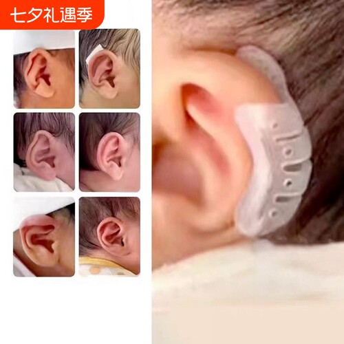 耳朵矫正器婴辅助定型器材