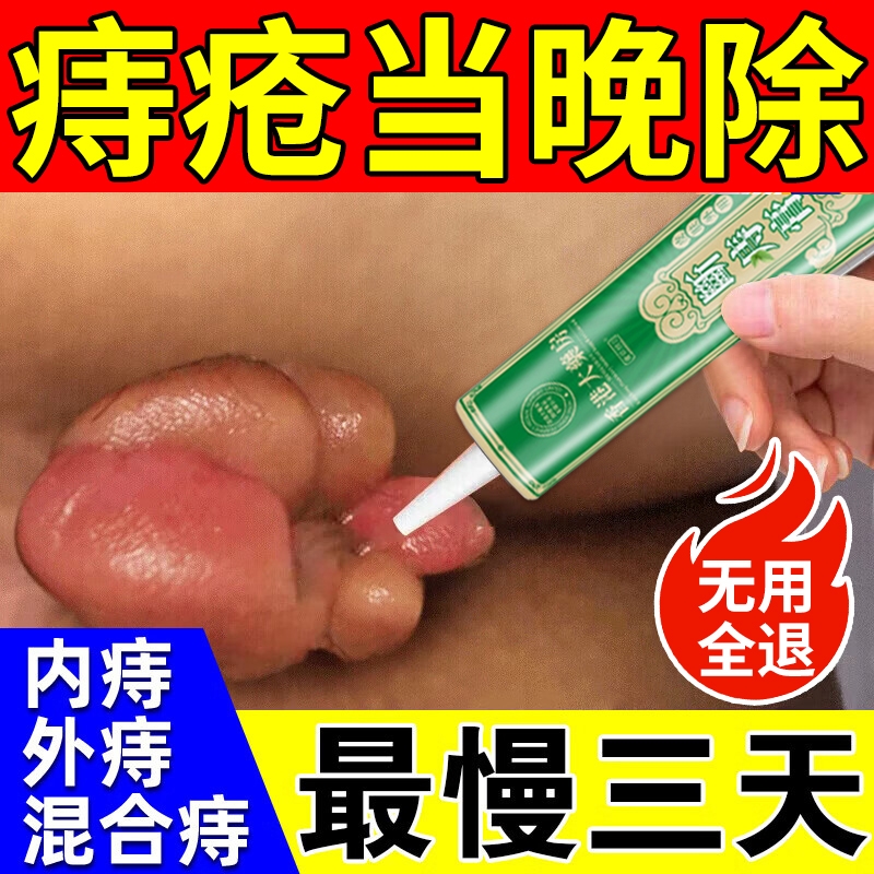 药房断货王】痔疮当天消