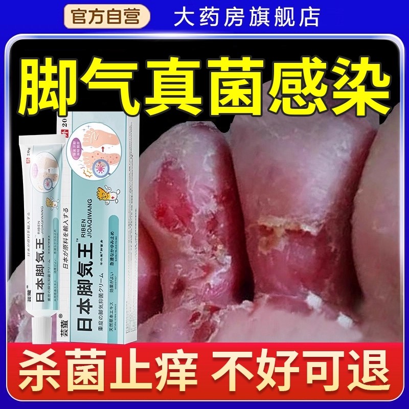 脚气臭脚痒出汗脚气喷雾止脱皮抑真菌脚泡脚丫根趾缝糜烂痒专用