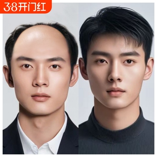 全递针真发假发男士超薄生物头皮无痕高端头顶补发片真人秃顶仿真