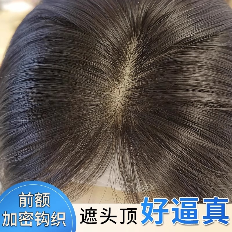 递针假发女片头顶真发夏天轻薄无痕蓬松高颅顶遮白发增发量补发片