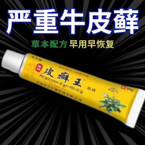 安兴堂藏药皮癣王乳膏20g皮肤外用抑菌软膏
