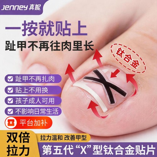 【无感矫正】走路不再痛