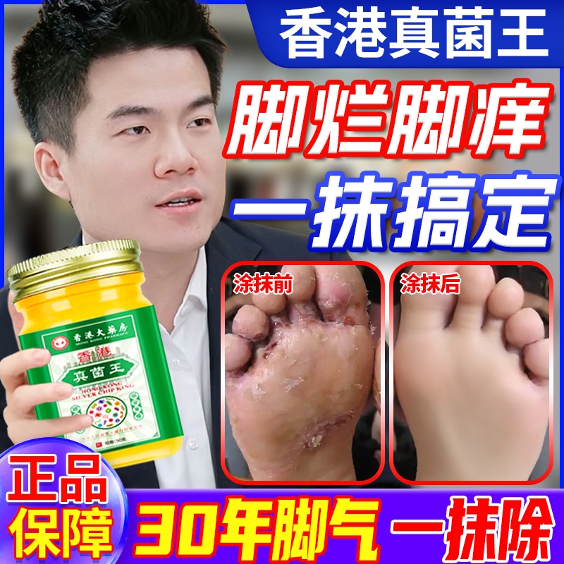 香港药房真菌王脚气膏止抑菌脱皮痒杀真菌感染脚气烂脚趾缝软膏