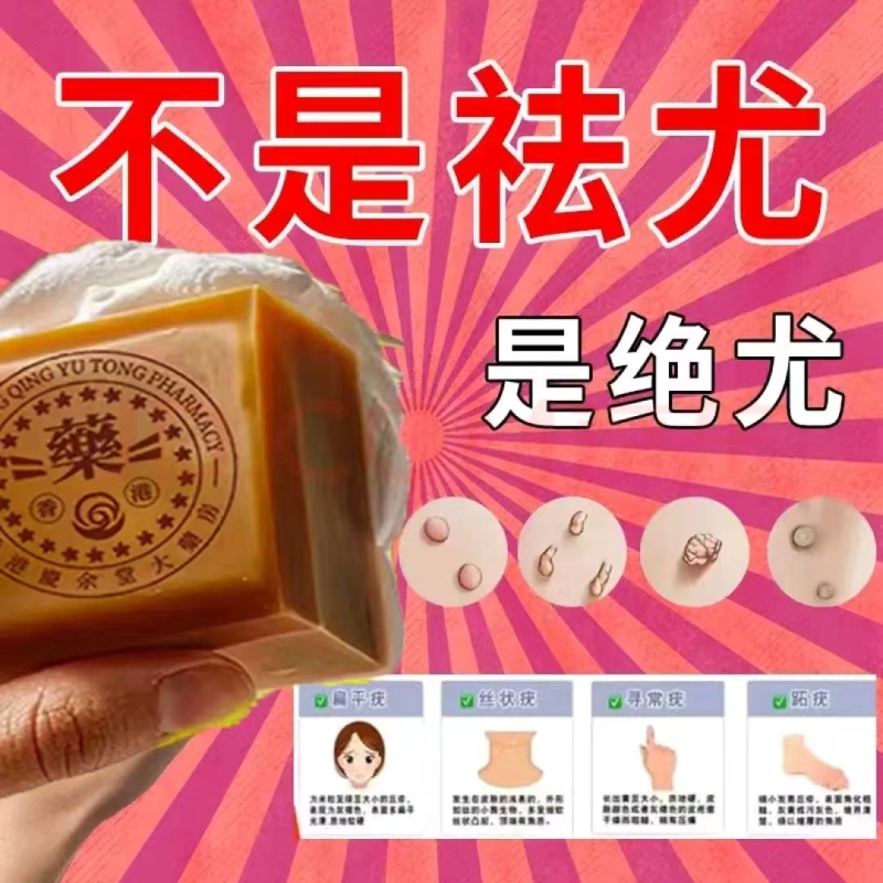 香港正品】脖子上长祛去尤疣瘊小肉粒肤康皂专用全身手工药香皂BA