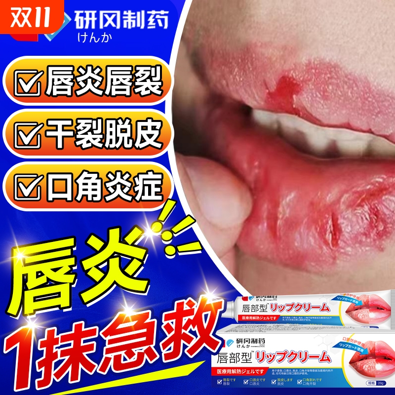 唇炎润唇膏嘴唇干裂脱皮专用保湿滋润去死皮口角炎疱疹修护医用型