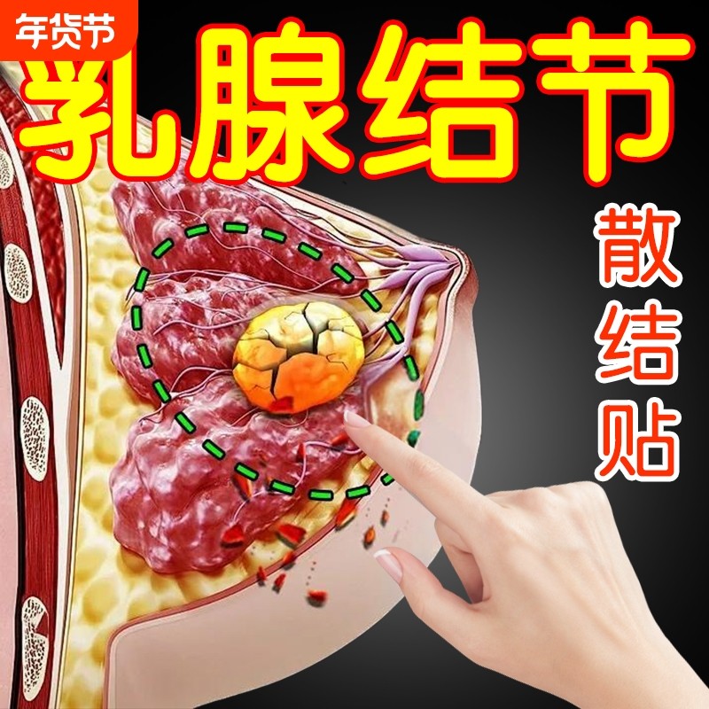 乳腺结节散结贴疏通硬块囊肿中药消乳房副乳胀痛炎溢液热敷理疗贴