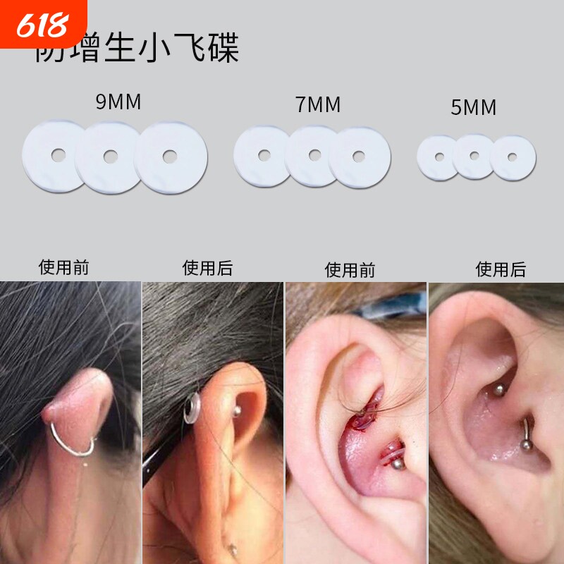 防增生小飞碟食品级硅胶耳洞耳骨钉垫片脐钉耳钉唇钉舌钉透明钛钢