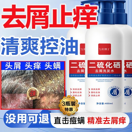 二硫化硒洗头水液控油蓬松去屑止痒洗发露男女官方正品旗舰店