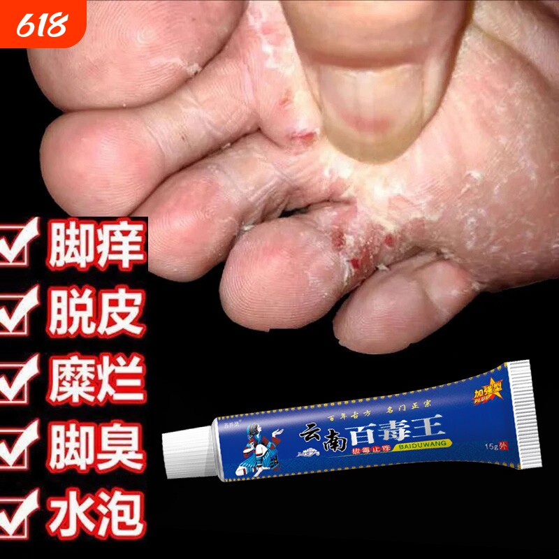 苗药百毒王药膏旗舰店抑菌奇草皮肤止痒膏脚丫子痒烂脚水泡草本