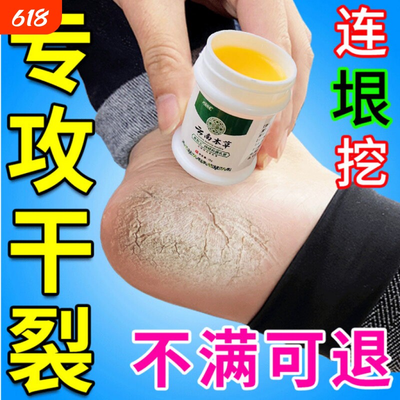 专治脚裂脚后跟干裂起硬皮足跟开裂真菌防皲裂脱皮修复霜药膏手足