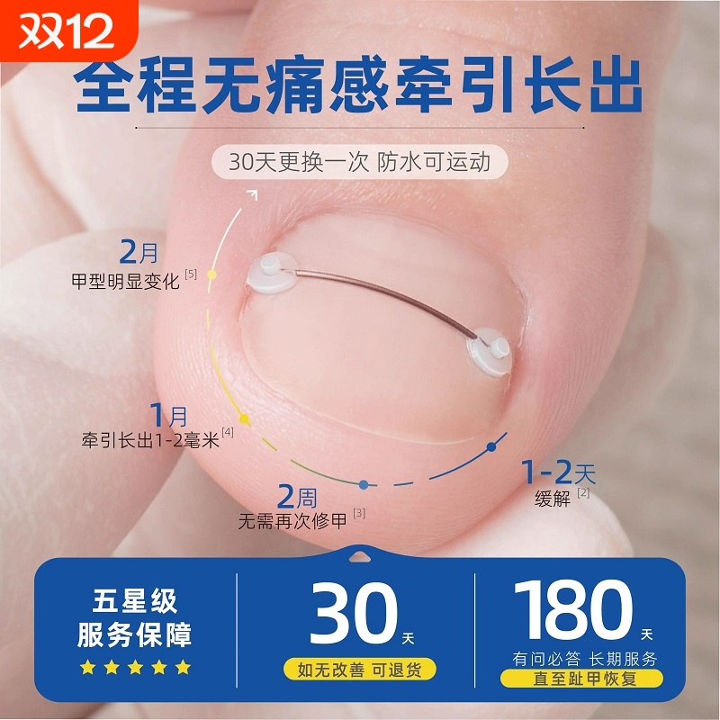 指甲矫正套装|超1000次加购