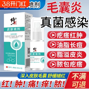 头皮毛囊炎喷雾剂头皮屑脂溢性皮炎药膏头部抑菌喷剂真菌感染头癣