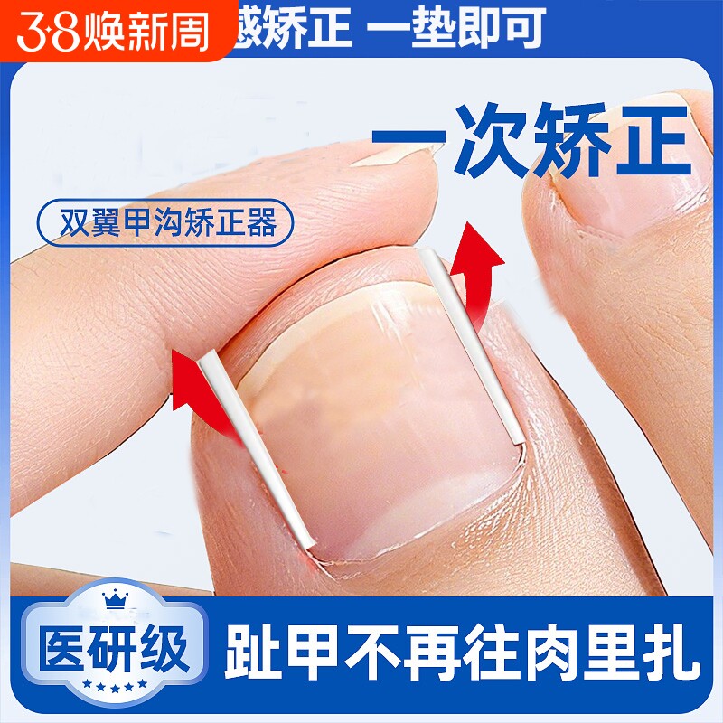 甲沟矫正神器炎指甲矫正器嵌甲正甲垫片脚趾甲往肉里长填充垫棉花