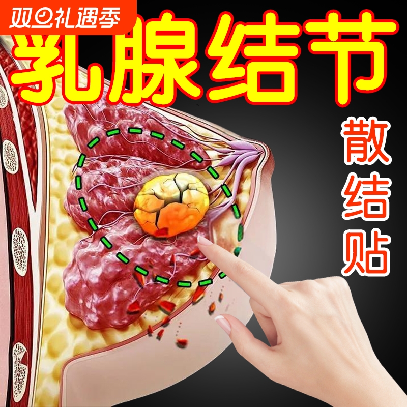 乳腺结节散结贴疏通硬块囊肿中药消乳房副乳胀痛炎溢液热敷理疗贴