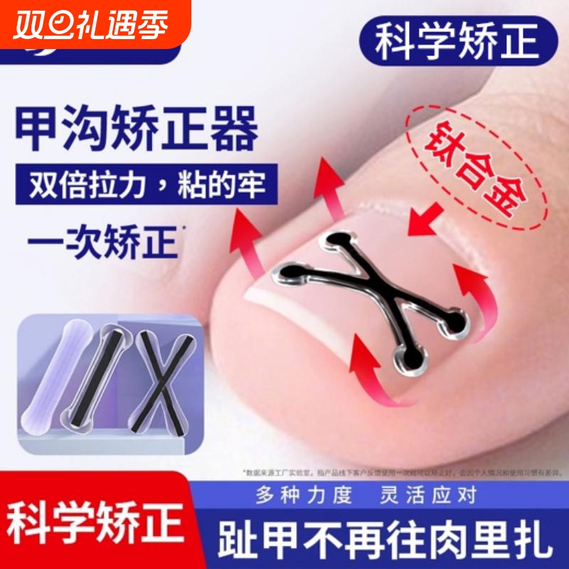 2025新款指甲矫正器甲沟嵌甲纠正贴脚趾头正甲贴片专用修脚工具炎