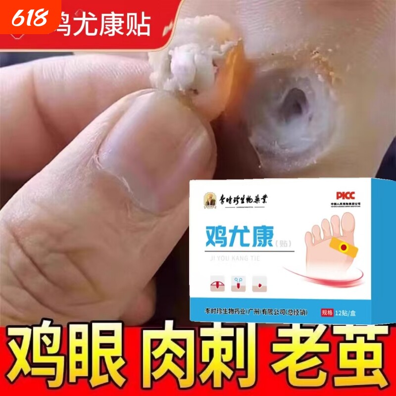 鸡眼贴去鸡眼神器老茧脚底钉祛除跖疣足部鸡贴眼膏正品官方旗舰店
