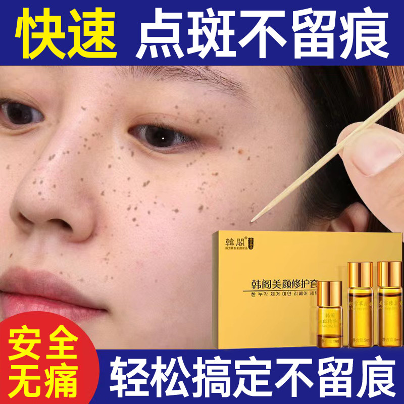 点斑水正品祛斑遗传雀斑否专用药水无佷水点斑液美容院金水旗舰店
