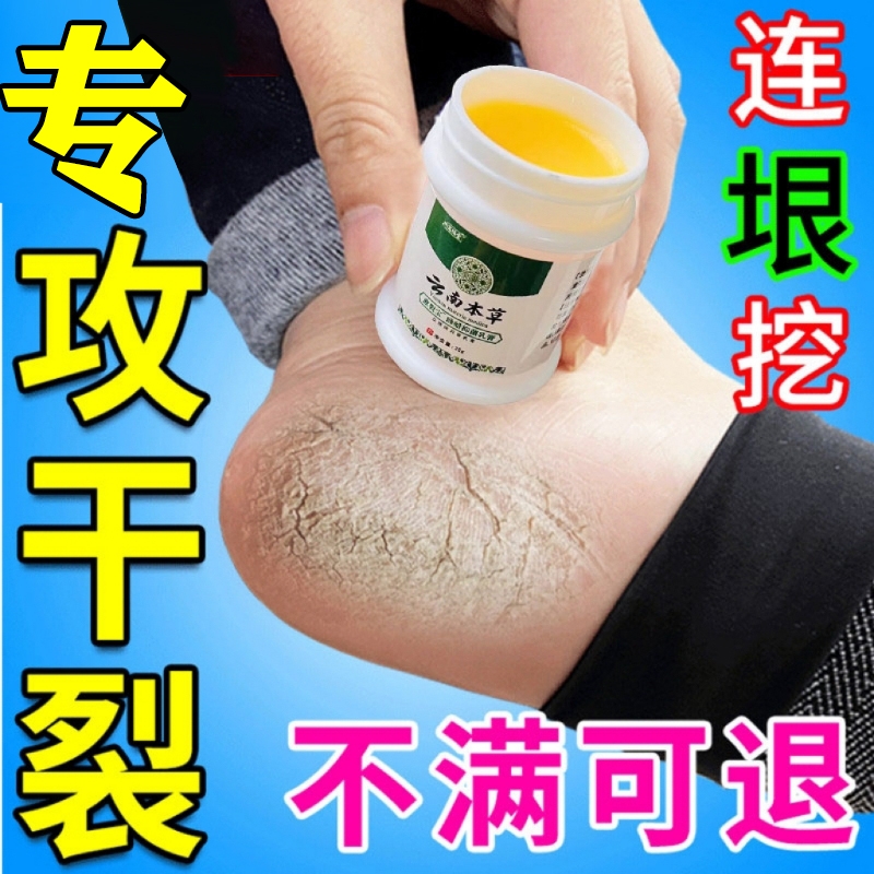 脚后跟干裂起硬皮足跟开裂去死皮软化剂护手霜脚跟角质滋润修复霜