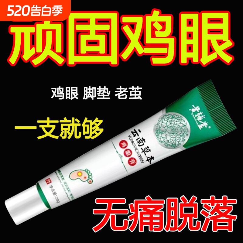 鸡眼膏鸡眼膏贴跖老祛茧肉刺脚趾鸡眼软膏官方正品鸡眼膏