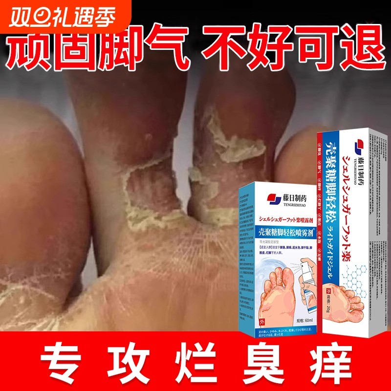 脚气痒皮杀菌喷雾去烂脚丫真抑菌感染糜烂除脚趾缝专用膏水泡修复