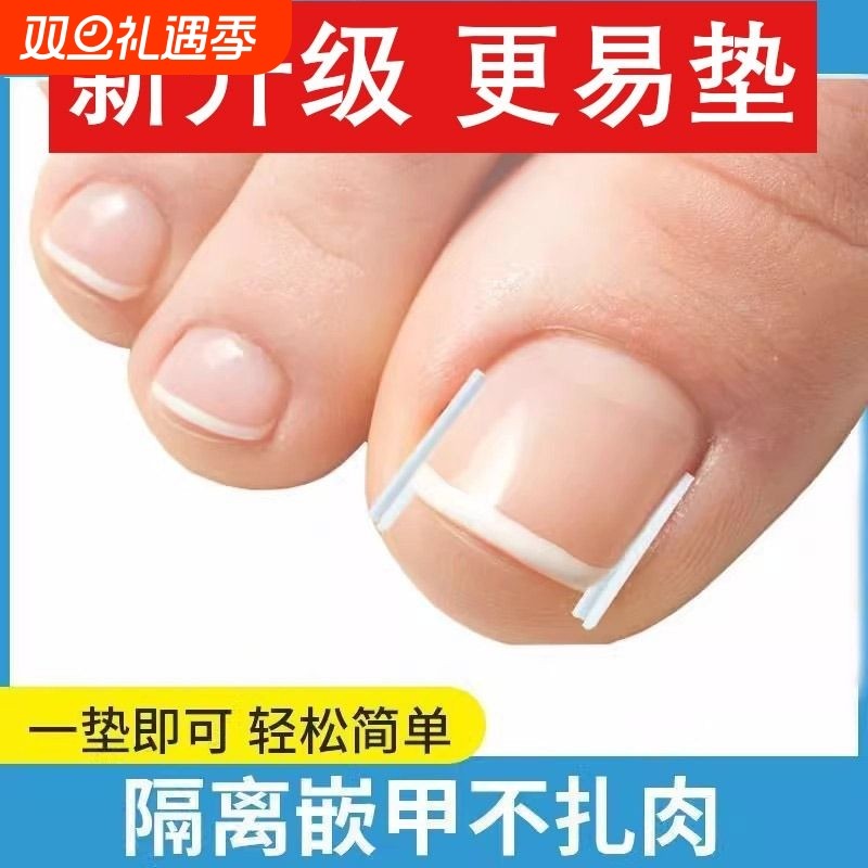 甲沟矫正神器指甲嵌甲专用隔离填充垫片脚趾甲往肉里长纠正甲贴