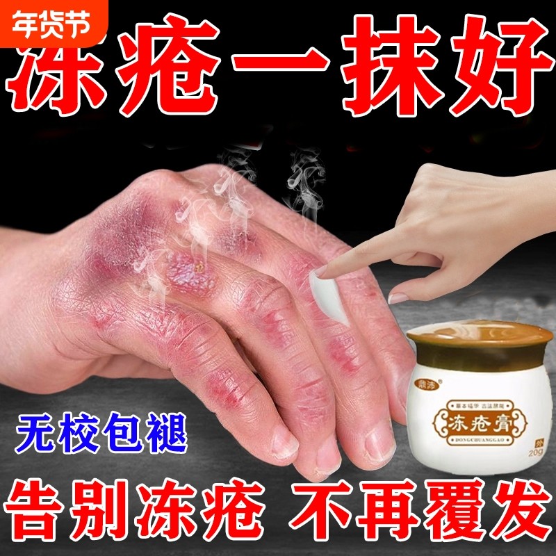 冻疮膏止冻伤痒膏排行榜第一脚干裂防冻保湿护手霜M防裂滋润脚跟,洗护清洁剂/卫生巾/纸/香薰,护手霜,淘宝优惠券,粉丝福利购,淘宝优惠卷