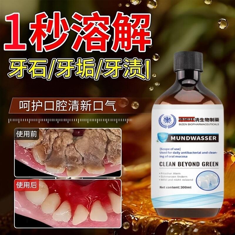 【爆款断货王】牙石溶解漱口水洗牙齿污垢牙垢黄牙渍清理神器正品