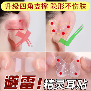 蝴蝶精灵耳贴强支撑女生隐形显脸小固定招风耳矫正器立耳定型神器