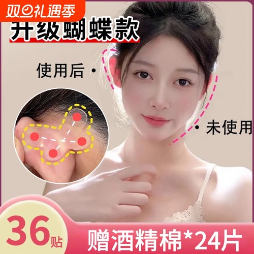 升级蝴蝶型异型精灵定型神器耳朵耳贴支撑贴面矫正器立耳隐形显脸