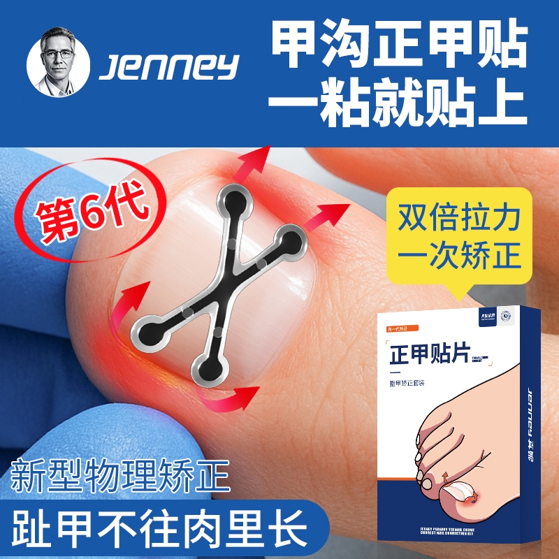 【无感矫正嵌甲】3天显效矫正器