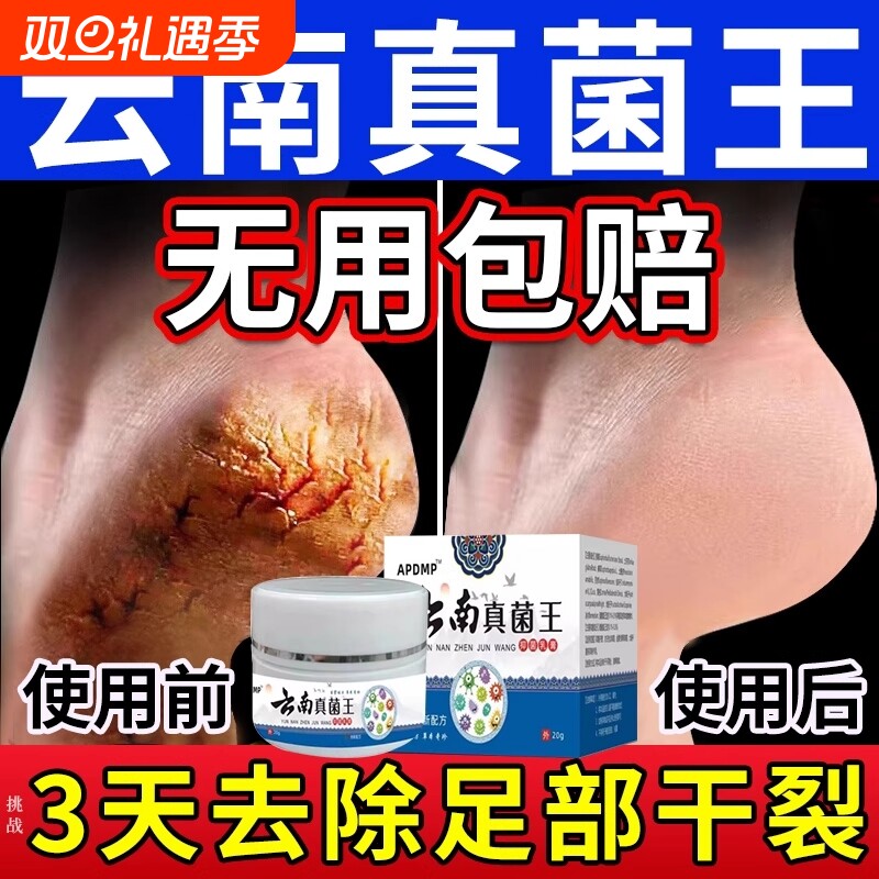 脚后跟干裂修复霜手足开裂皲裂治起皮去死皮润马油皱裂膏保湿滋润