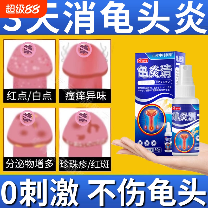 男性龟头炎包皮炎真菌感染豆腐渣白垢红肿珍珠丘疹冠状沟疹粒喷剂