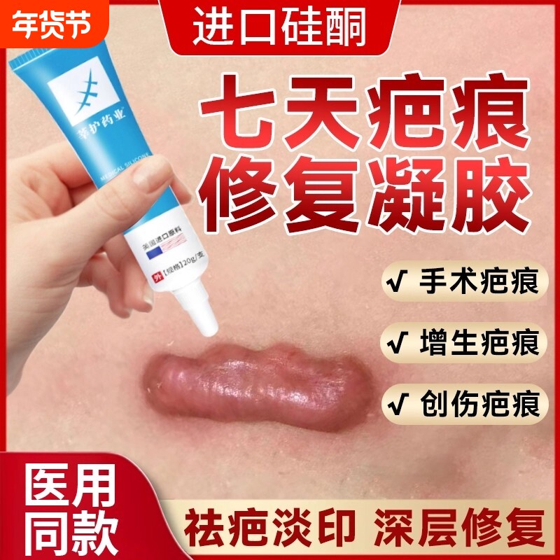 祛疤膏去疤膏除疤痕增生凸起去除疙瘩修复手术剖腹产医用硅酮凝胶