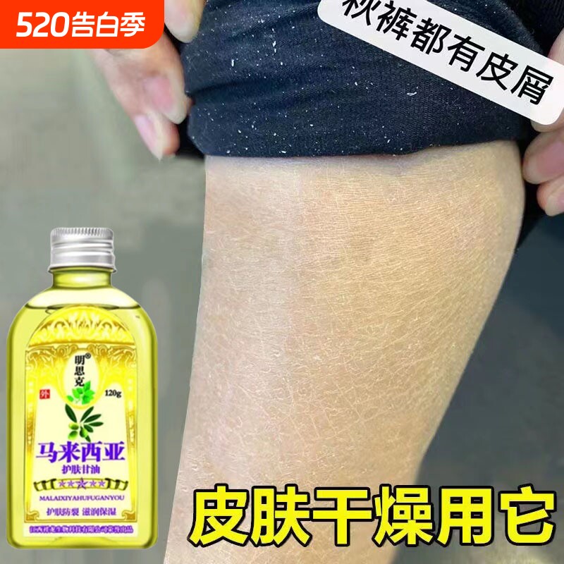 小腿干燥起皮鱼鳞皮肤霜秋冬皮肤干痒儿童护肤甘油身体润肤油止痒