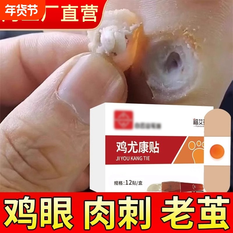 鸡眼贴膏去跖疣除老茧根官方正品旗舰店脚底脚后跟趾根肉刺医用,医疗器械,保健理疗,淘宝优惠券,粉丝福利购,淘宝优惠卷