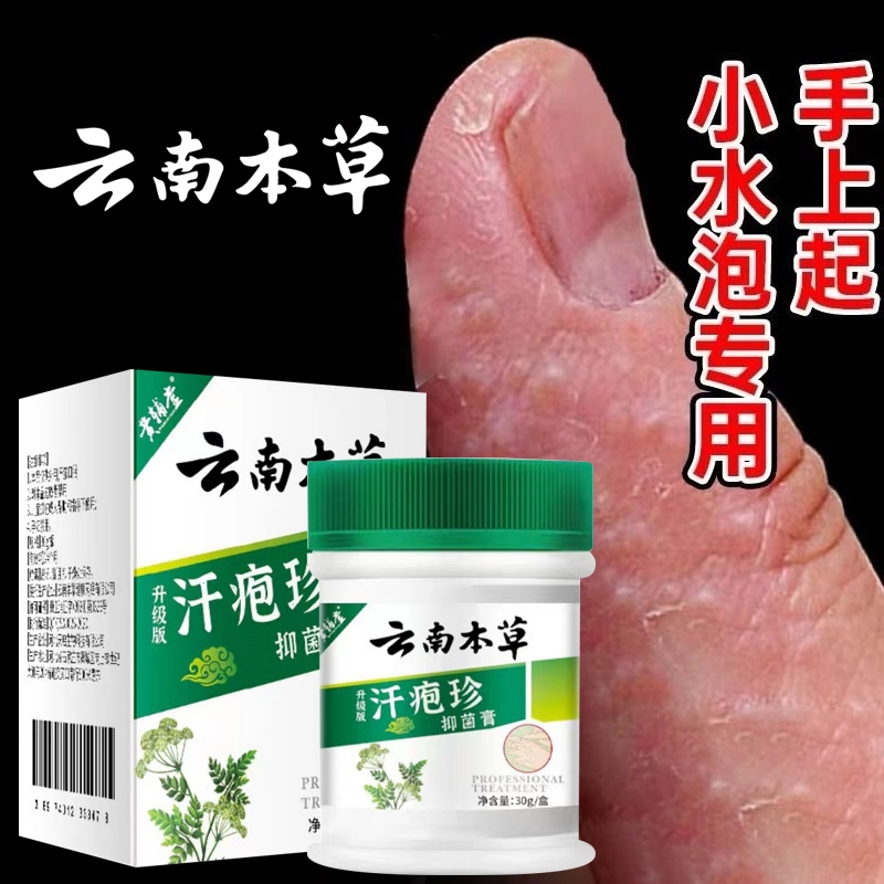 云南本草汗疱疹手上红起小水泡手痒汗状湿疹止痒皮肤专用软膏持久