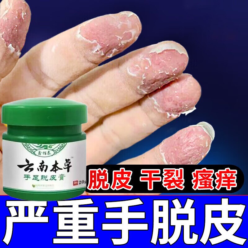 治脚底干裂脱皮脚趾缝烂瘙痒起水泡真菌感染臭脚出汗鳞屑角化克星