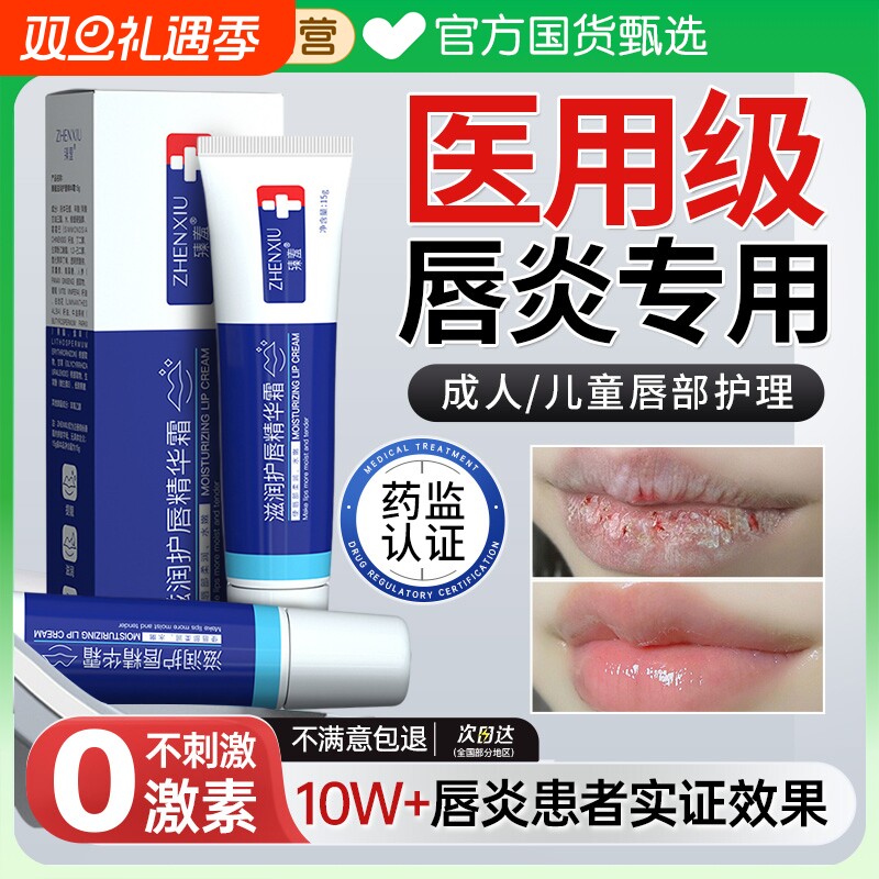 唇炎润唇膏嘴唇干裂脱皮专用保湿滋润去死皮口角炎疱疹医用修护膏