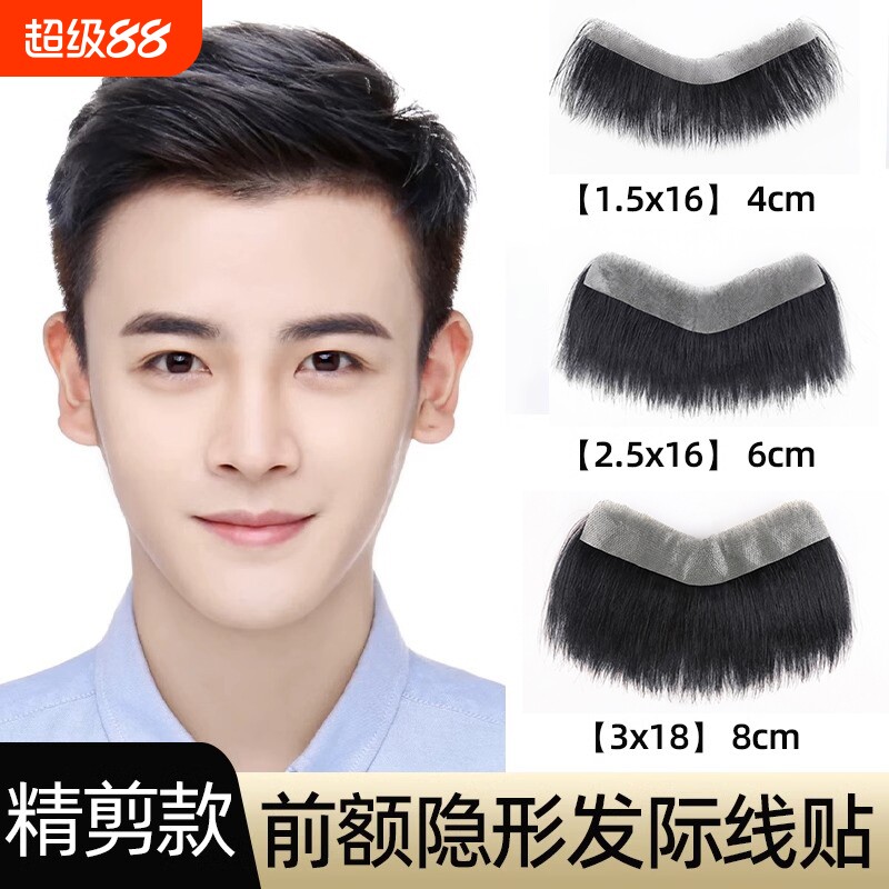 许尚发真人发丝前额补发送胶片图片