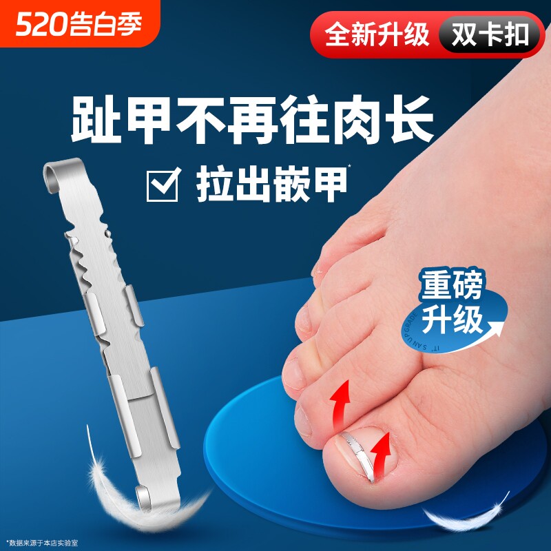 正甲扣甲沟矫正器脚趾甲卷指甲长肉里纠正器炎嵌甲神器工具修脚刀