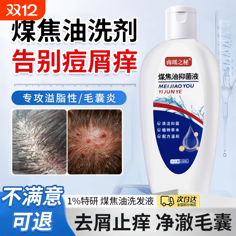【销量No,I】煤焦油洗剂洗发水