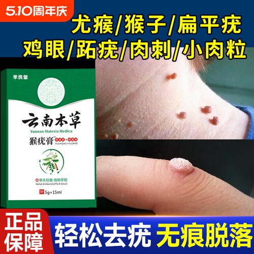 去除瘊疣扁平疣特效|千人加购