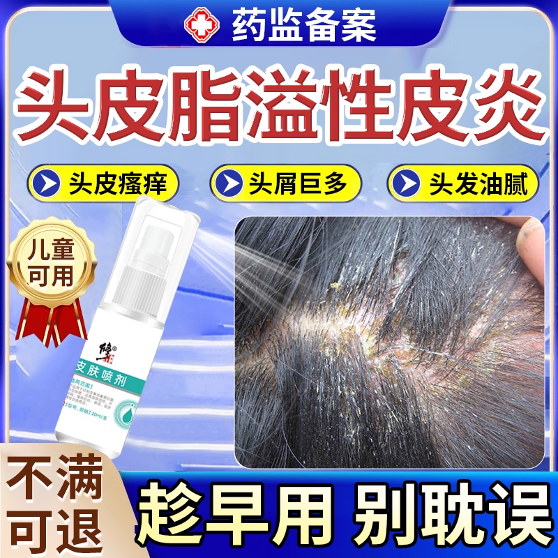 头皮毛囊炎喷雾剂头皮屑脂溢性皮炎药膏头部抑菌喷剂真菌感染头癣
