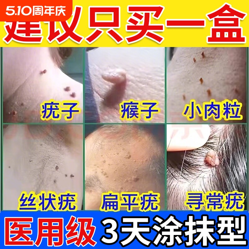 正品克优膏去除疣瘊肉粒云南本草扁平专用丝状神器疣官方旗舰店