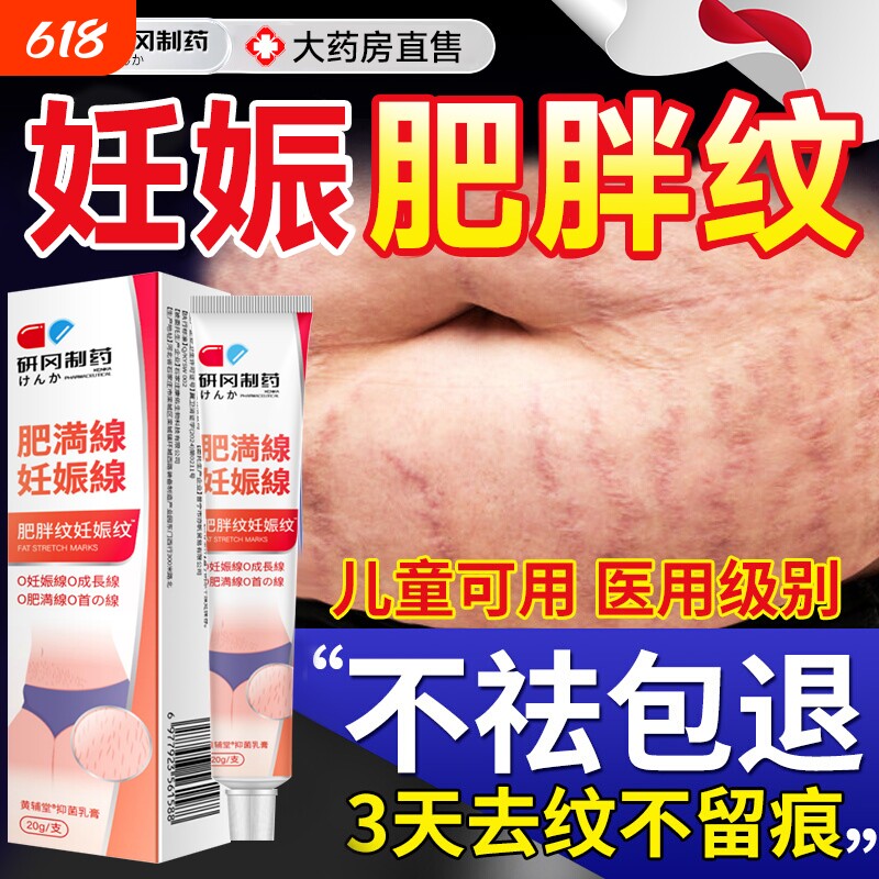 去妊娠纹肥胖纹修复霜生长纹消除学生男去紧致肚皮去除硅酮疤痕
