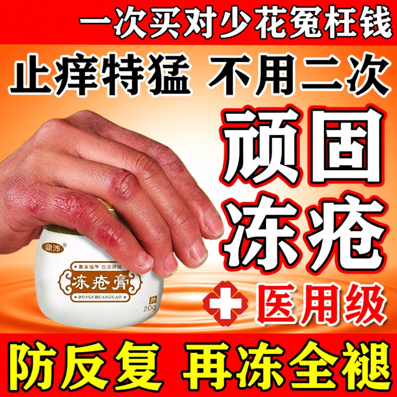 冻疮膏止痒冻伤膏正品排行榜第一名特效冬天防冻裂脸耳朵手足X药